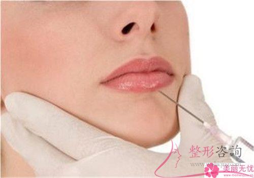 注射<a href=http://www.mx185.com/listinfo-731-0.html target=_blank class=infotextkey>玻尿酸</a>丰唇（Hyaluronic acid enriches lips）到最后5877元够不够