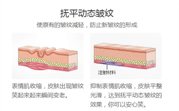 注射<a href=http://www.mx185.com/listinfo-614-0.html target=_blank class=infotextkey>除皱</a>哪种材料比较好?